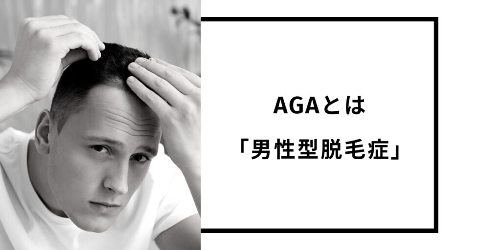 AGAとは「男性型脱毛症」